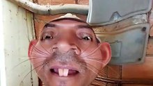 1000090179