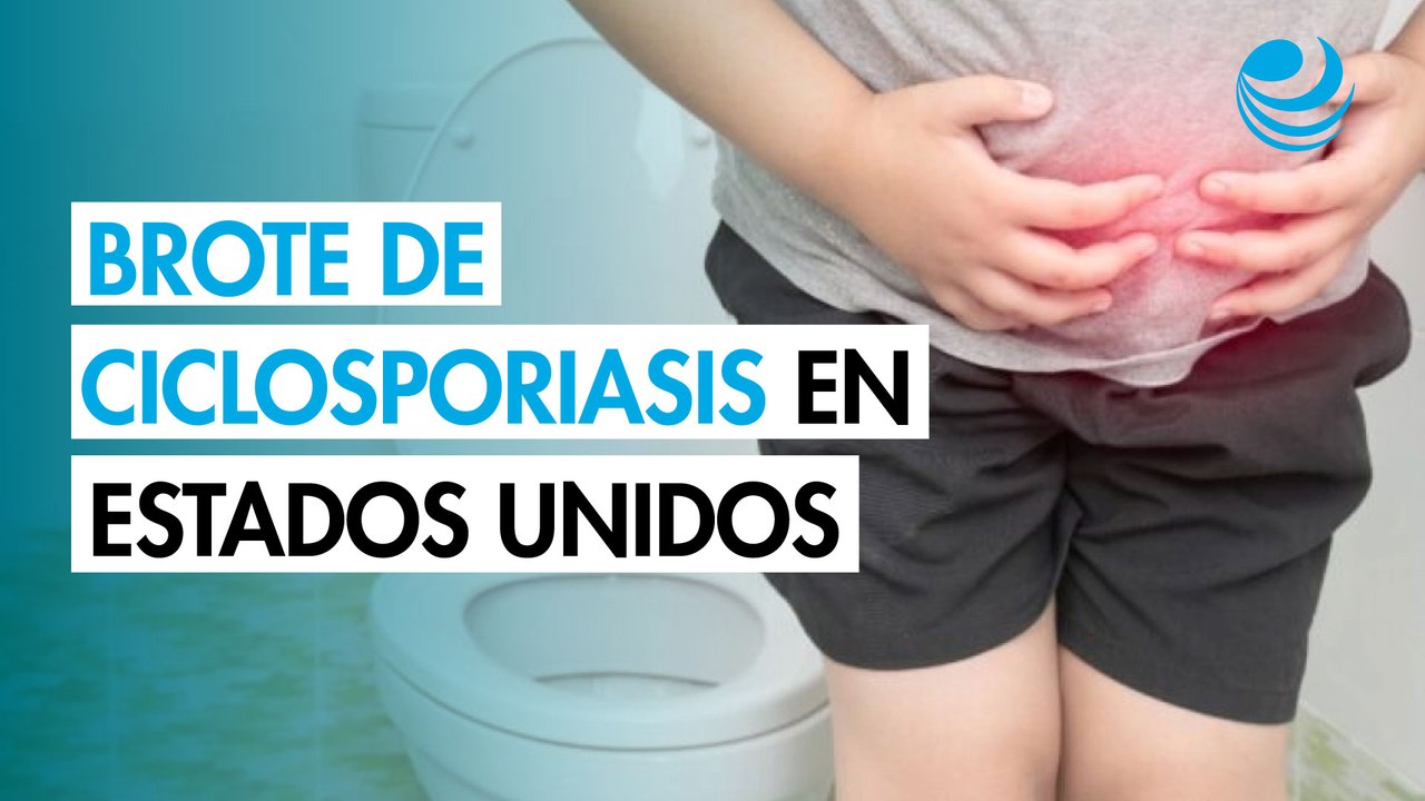Ciclosporiasis: ¿Qué es, cuáles son los síntomas y cómo se contagia la "diarrea explosiva"?
