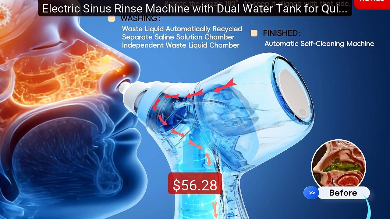 Electric Sinus Rinse Machine with Dual Water Tank for Quick Relief ... -- Top Rated 2026 | Buy Now!