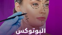 البوتوكس صعب حياتنا؟