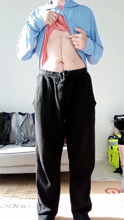 【Day 022】After Cancer & Total Stomach Removal|500 Gratitude Punches 4 Body Recovery HXH Netero Style