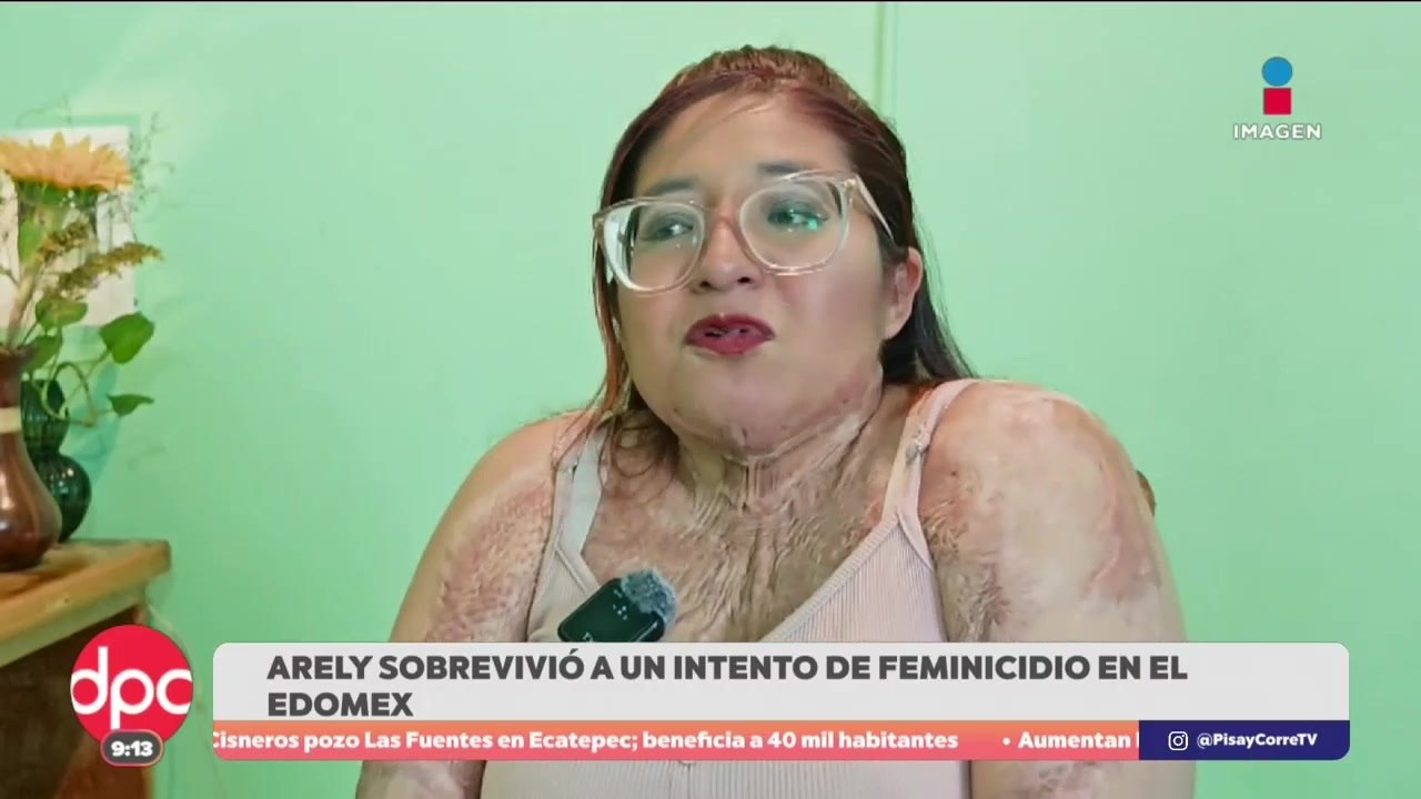 La lucha de Areli Viridiana tras sobrevivir a un intento de feminicidio | De Pisa y Corre