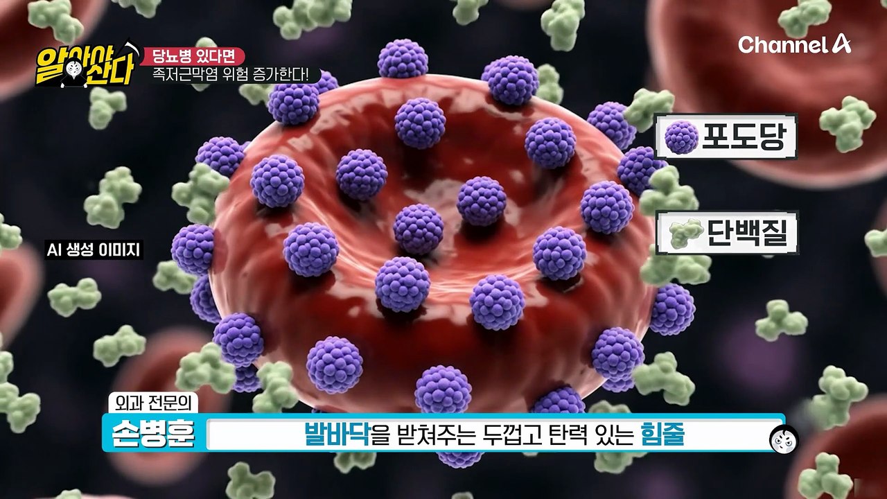 집에서도 슬리퍼 신는 이유? 당뇨병이 있으면 족저근막염이 더 잘 생긴다?