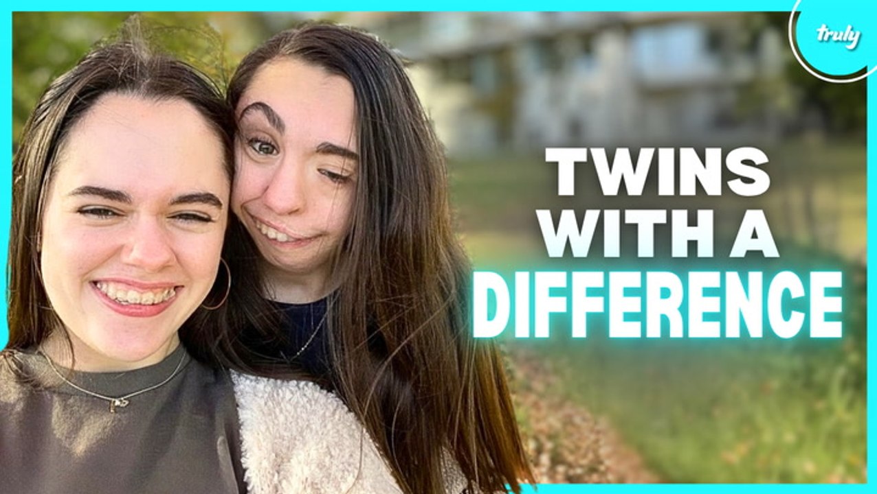 My Twin Was Born Without An Ear & Jawbone | BORN DIFFERENT