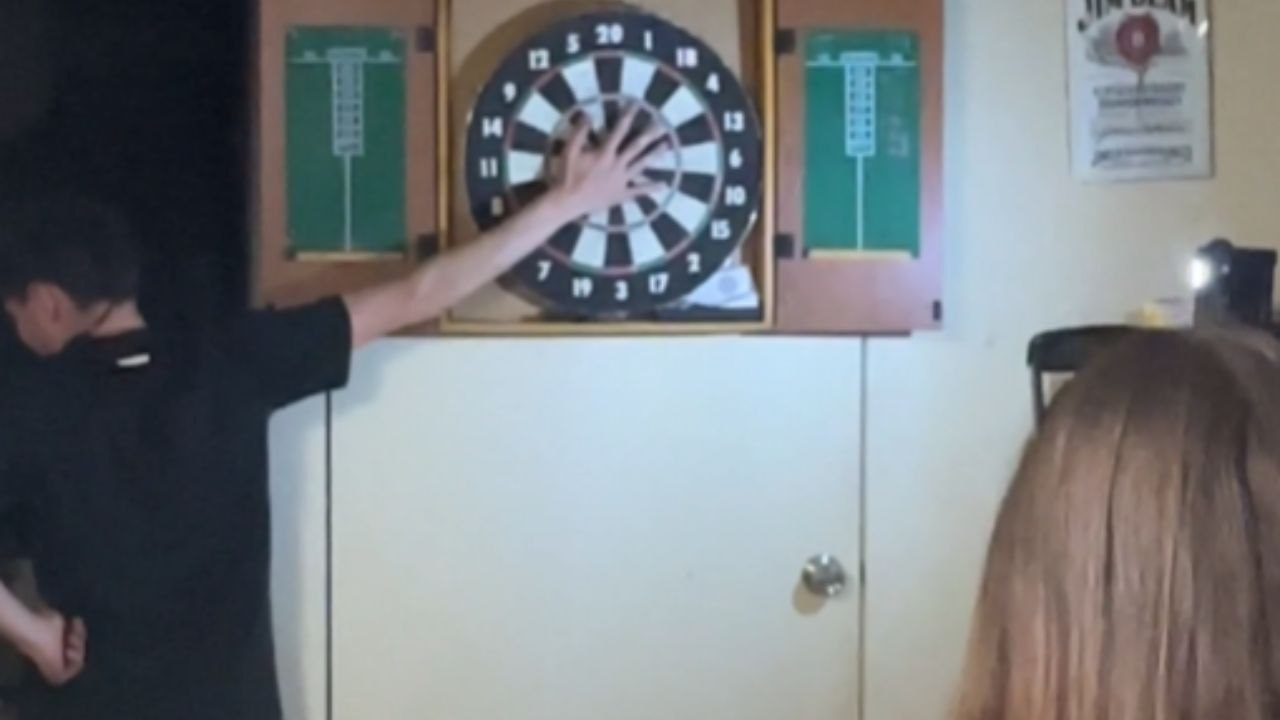 Boy Gets Injured As Dart Pierces His Hand On Weekend