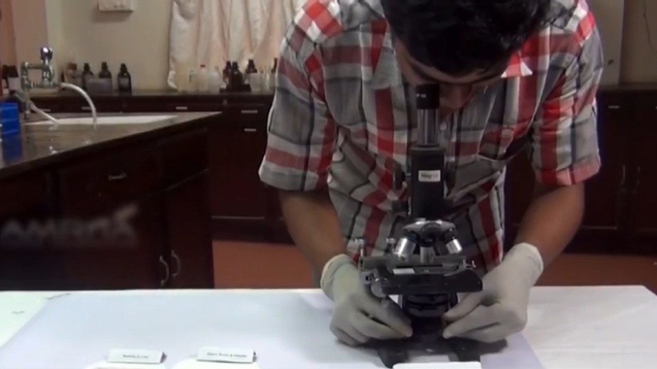 tn7-infecciones-comunes-se-estan-volviendo-imposibles-de-tratar-1907726