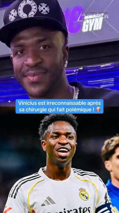 La chirurgie du menton de Vinicius fait polémique ! 🍿#vinicius #viniciusjr #foot #football