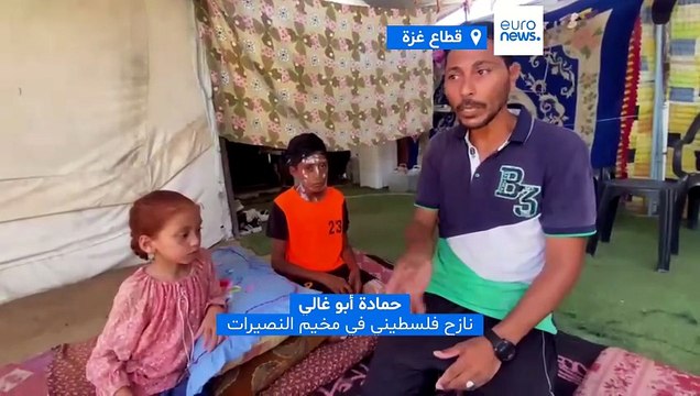 جدري الماء .. فيروس شديد العدوى ينتشر بسرعة الصاروخ بين نازحي غزة