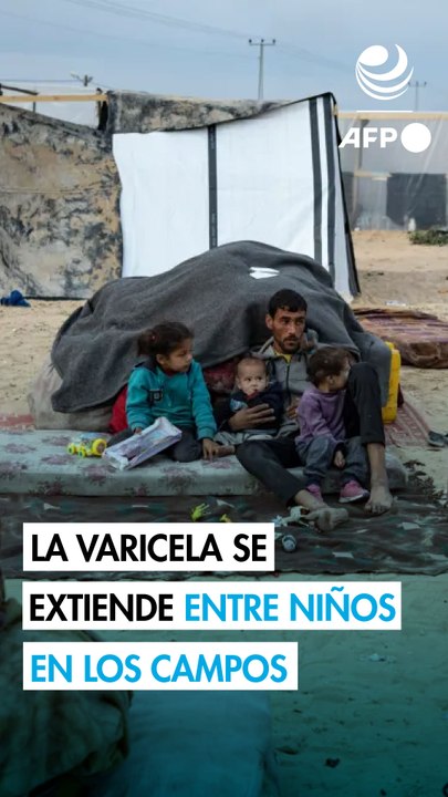 La varicela se propaga en los saturados campamentos de Gaza