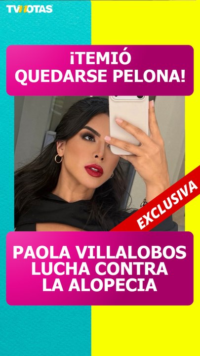 Paola Villalobos revela que la alopecia le provocó una fuerte depresión: "Casi me desmayo"