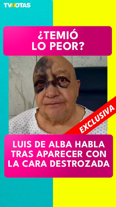 Luis de Alba habla tras su aparatosa caída y revela cómo se encuentra de salud