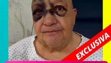 Luis de Alba habla tras su aparatosa caída y revela cómo se encuentra de salud