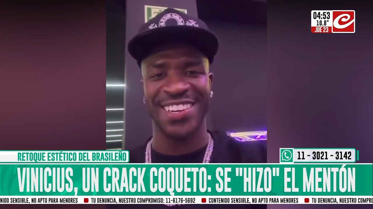 Vinicius se operó el mentón y mostró el resultado en las redes
