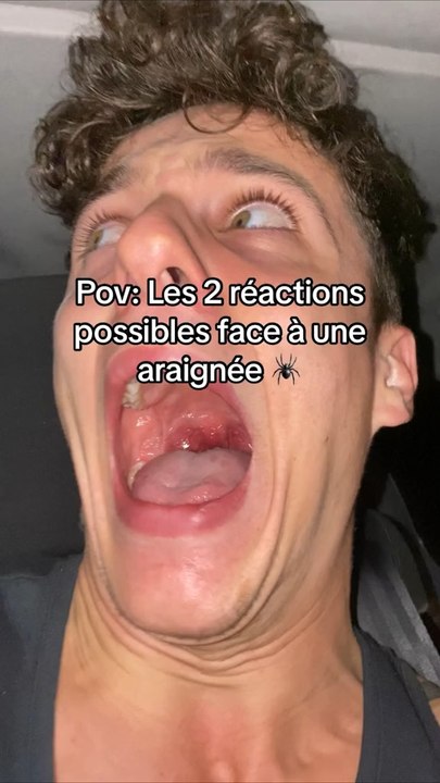 L’ARAIGNÉE 🕷️🙈