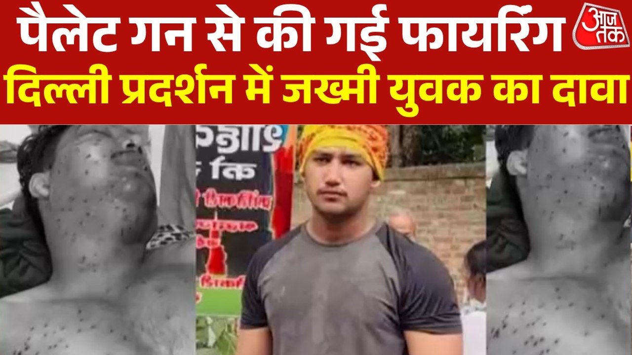 'दिल्ली में पैलेट गन से की गई फायर‍िंग, जख्मी प...