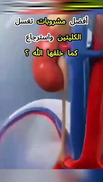 مشروبات تغسل الكليتين وتسترجعها كما خلقها الله