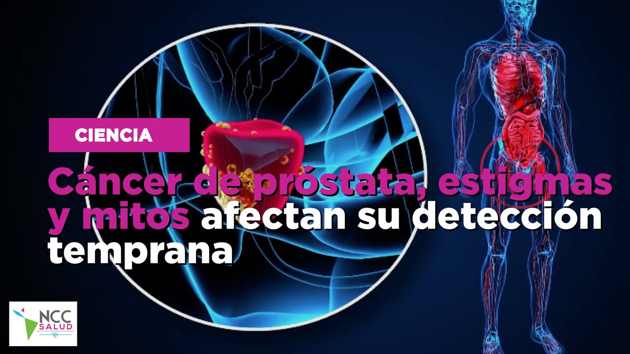 El cáncer de próstata y la importancia de prevenirlo
