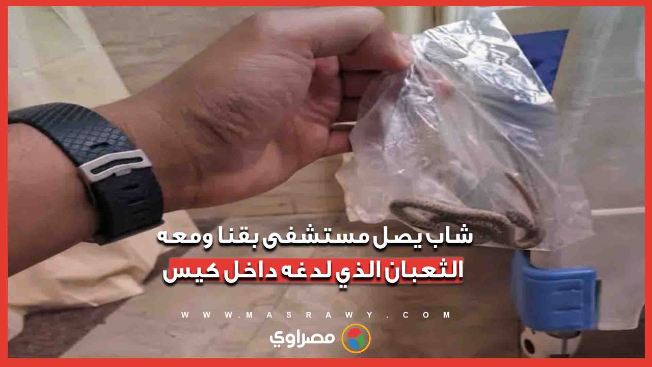 شاب يصل مستشفى بقنا ومعه الثعبان الذي لدغه داخل كيس
