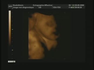 soizig dans mon bidon 2