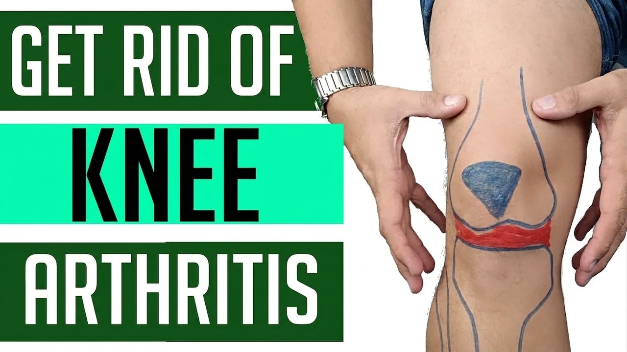 Knee Osteoarthritis? 4 Exercises to Feel Better Fast!