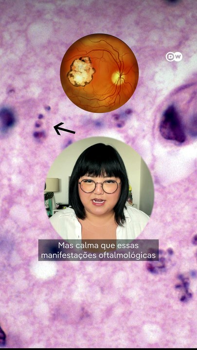 Toxoplasmose, uma doença tropical negligenciada