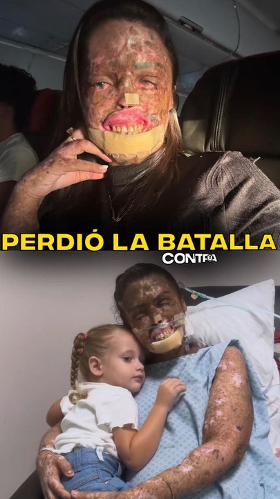 Perdió la batalla contra su enfermedad