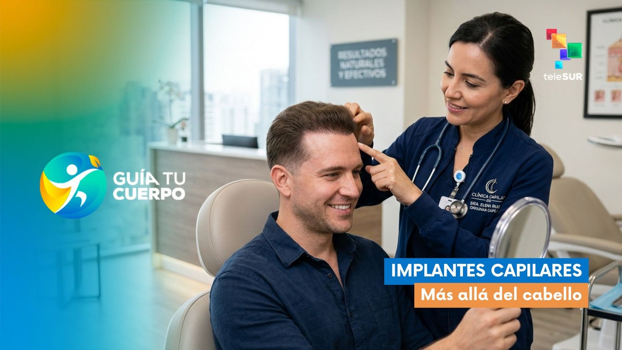 GUÍA TU CUERPO | Implantes capilares: Más allá del cabello 28-07-2026