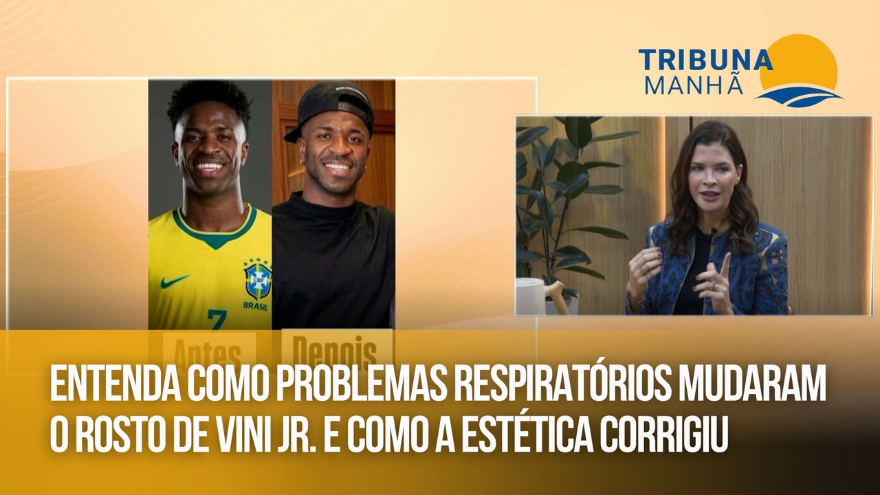 Entenda como problemas respiratórios mudaram o rosto de Vini Jr. e como a estética corrigiu