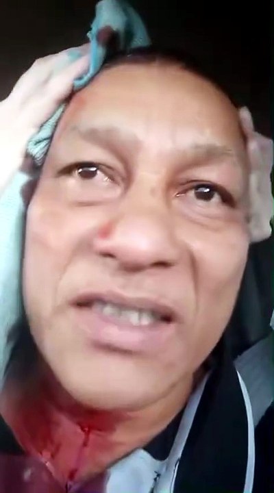 'Me rozó la frente': chofer de rapidito sobrevive a disparo durante asalto