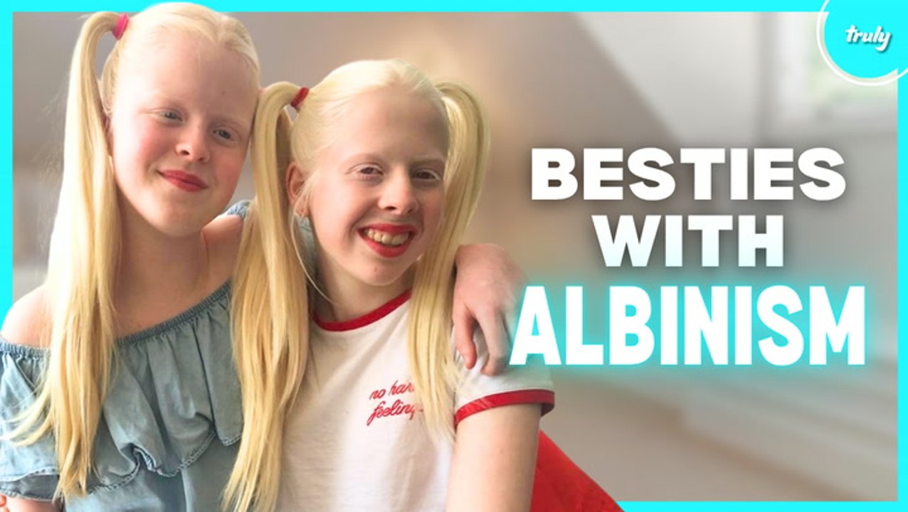 The Besties With Albinism: 7 Years Later | BORN DIFFEREN