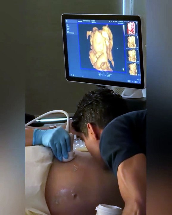 Bebé reacciona, desde el vientre de su madre, caricas