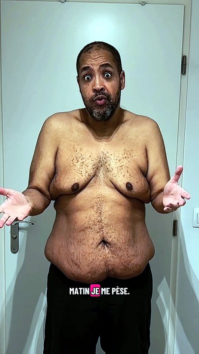 En mai 2025, j’ai eu un vrai déclic après une hospitalisation d’urgence à cause de mon diabète. J’ai passé 10 jours à l’hôpital et je pesais 189,9 kg.Depuis ce jour, j’ai décidé de reprendre ma santé en main.