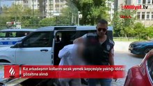 Kız arkadaşının kollarını sıcak yemek kepçesiyle yaktığı iddiası