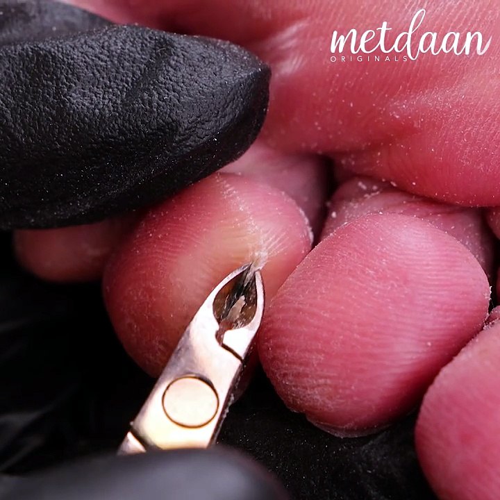A pedicure transformation you should see! 👣✨