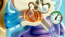✈️ Ever wondered why your ears suddenly pop during takeoff or landing
