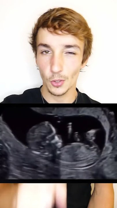 Bébé imagerie