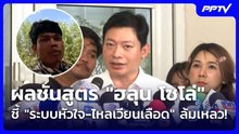 ผลชันสูตร "ฮลุน โซโล่" ชี้ "ระบบหัวใจ-ไหลเวียนเลือด" ล้มเหลว!| โชว์ข่าวเช้านี้ | 7 ส.ค. 69