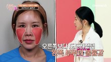 나쁜 생활 습관과 수술 부작용으로 생긴 비대칭! 완벽 회복 가능?!