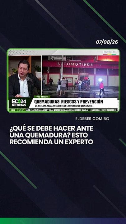¿Qué se debe hacer ante una quemadura? Esto recomienda un experto