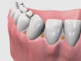 Stop Bad Breathe Fast Remedies