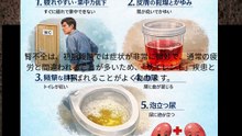 腎不全の初期段階の 5 つの症状を認識し、治療が早ければ早いほど回復しやすくなります。