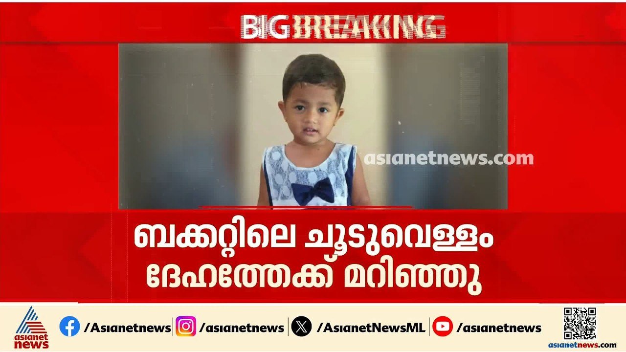 കൊച്ചിയിൽ ചൂടുവെള്ളം വീണ് പൊള്ളലേറ്റ് ചികിത്സയി...