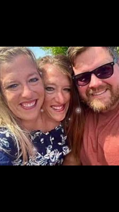 Conjoined twins Abby and Brittany Hensel share...