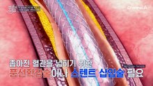 20년 전 시작된 혈관의 경고! 생사의 갈림길에서 살아남은 부부?!