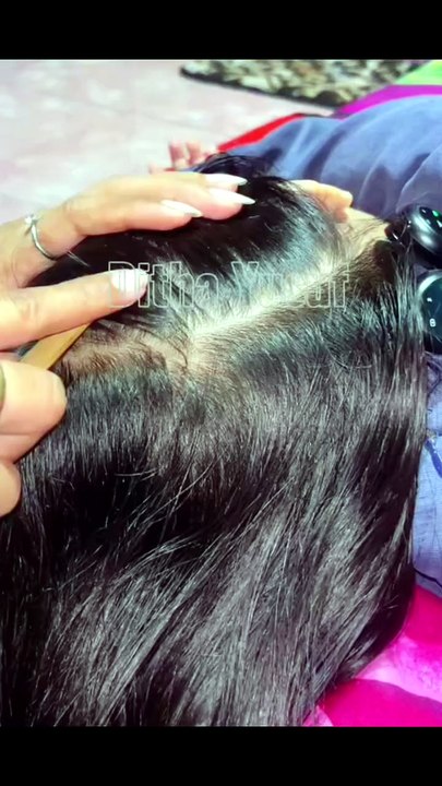 Lice Removal