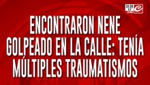 ¡Madre monstruo! Nene de 5 años escapó de su casa molido a golpes