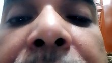 1000007992