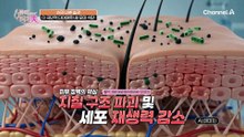 급찐급빠 다이어트하려다 피부 건강 스스로 망쳤다?! 새 모이 식단의 문제점