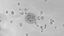 A closer look at robots built entirely from human cells