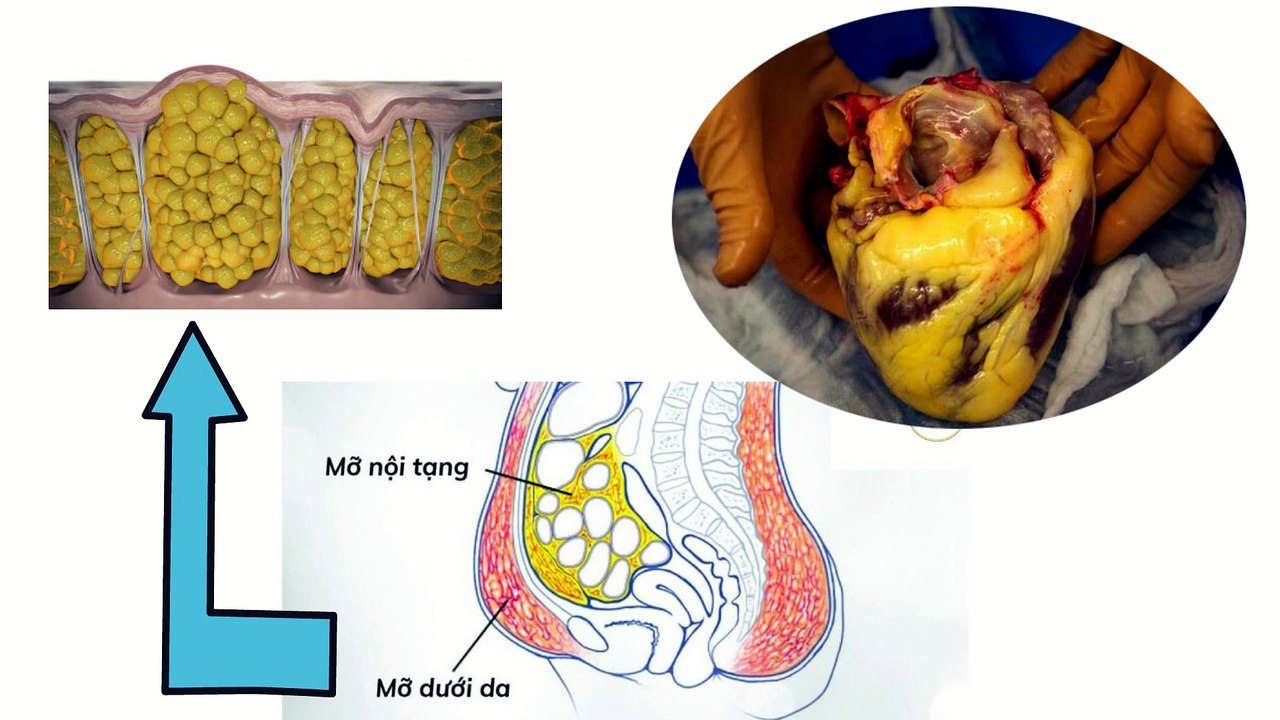 Những -dại dột- khi muốn giảm cân thật nhanh